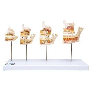 치아 성장 모형 Dentition Development D20 [1000248]